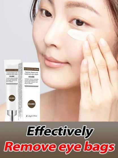 Eye Cream Remove Dark Circles