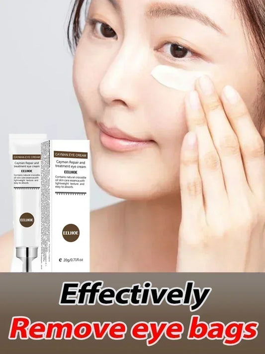 Eye Cream Remove Dark Circles