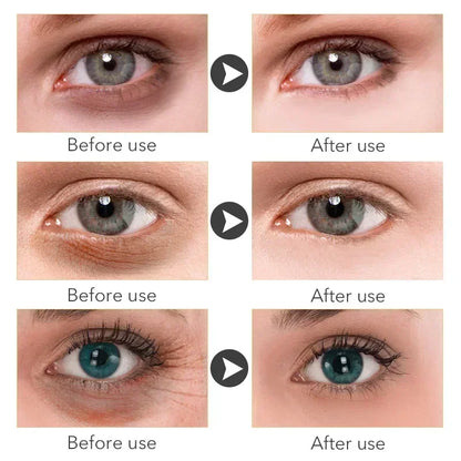 Eye Cream Remove Dark Circles
