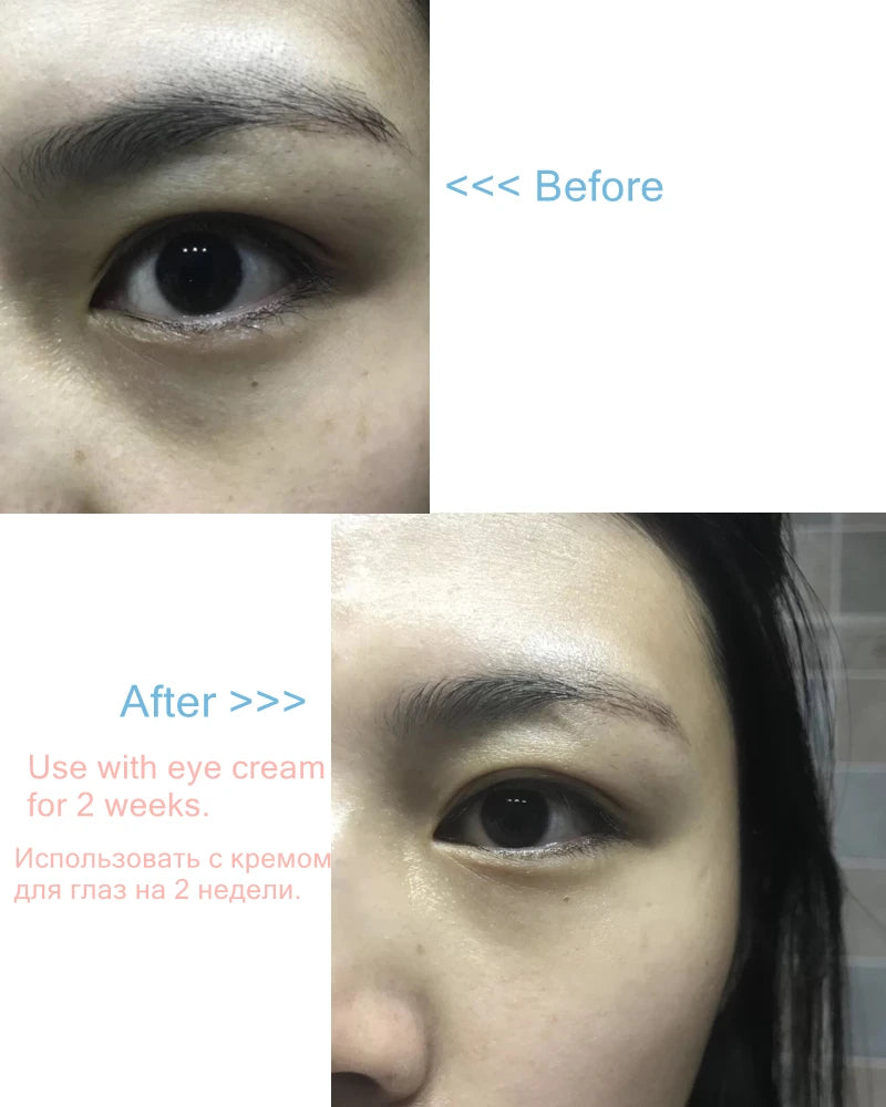 Eyes Fresh keeping Film Mask