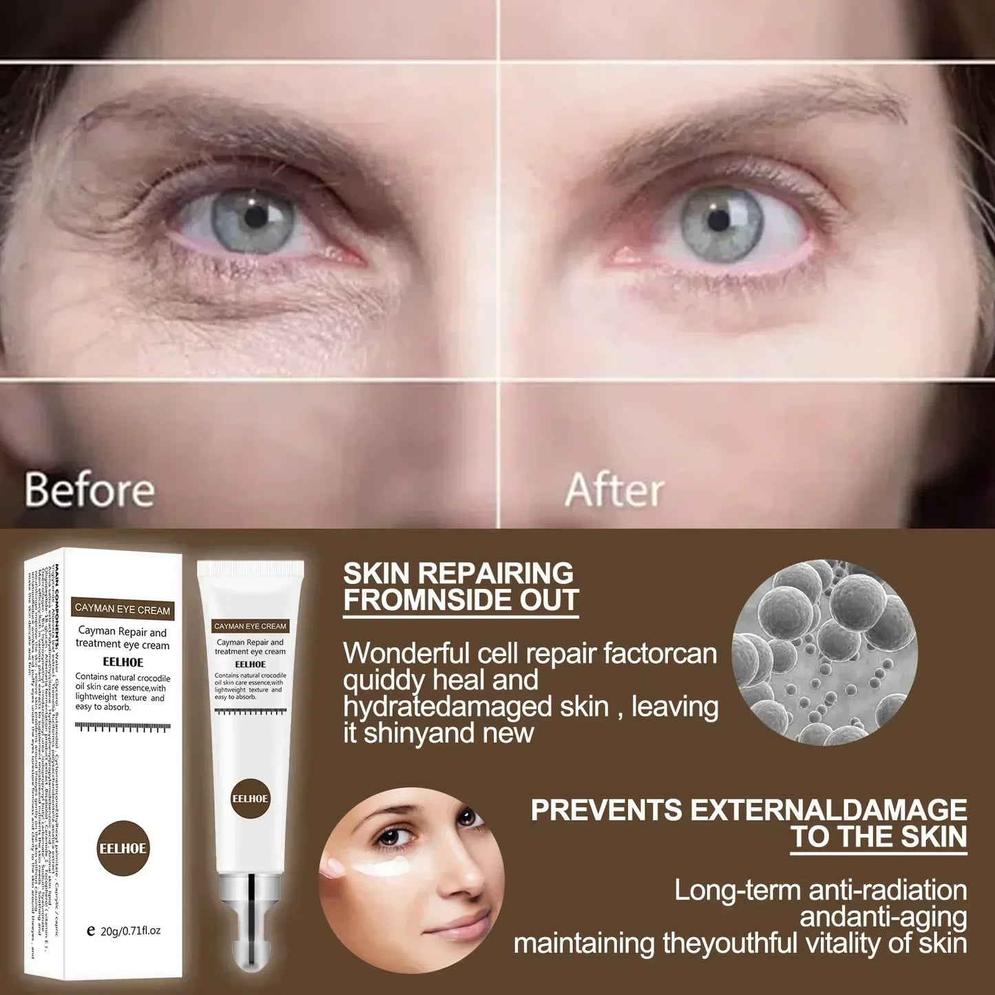 Eye Cream Remove Dark Circles
