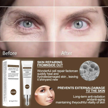 Eye Cream Remove Dark Circles