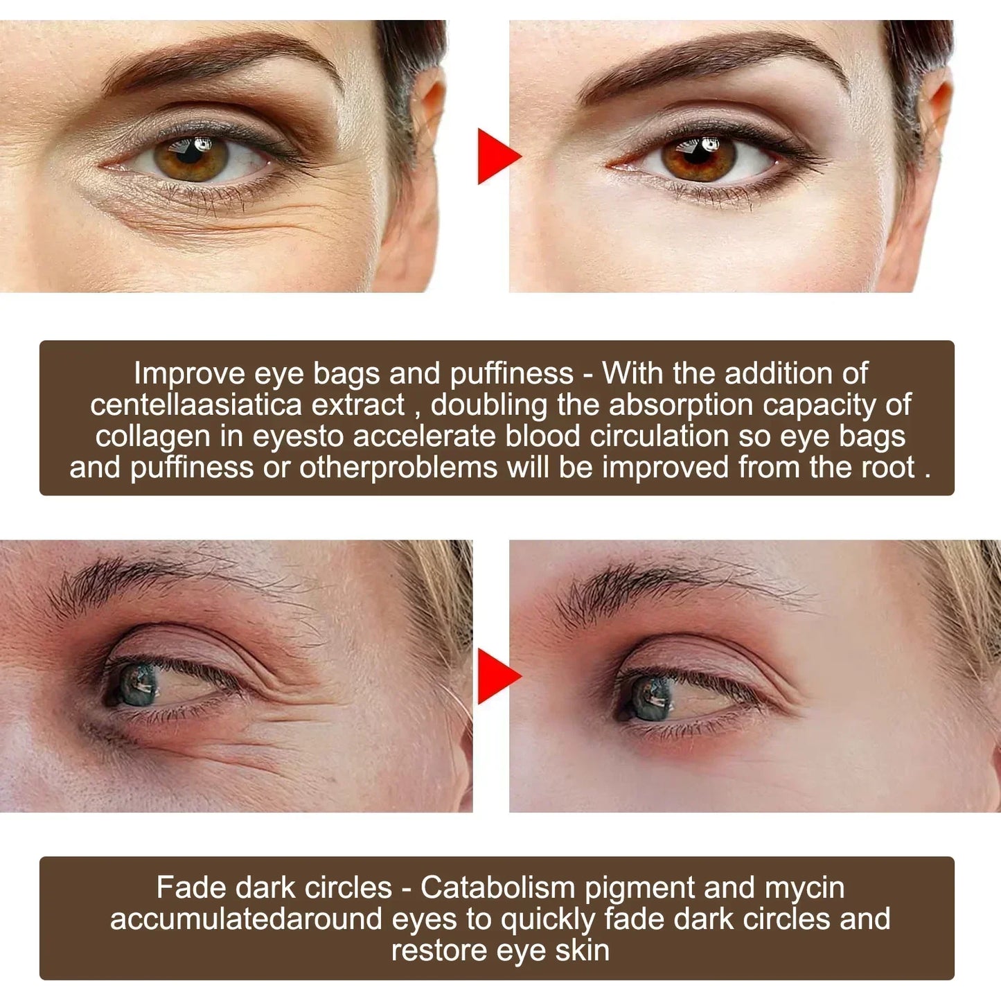 Eye Cream Remove Dark Circles