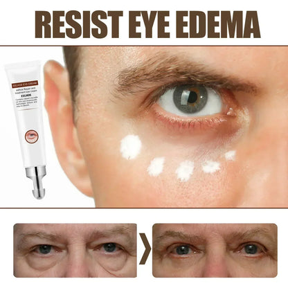 Eye Cream Remove Dark Circles