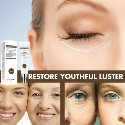 Eye Cream Remove Dark Circles